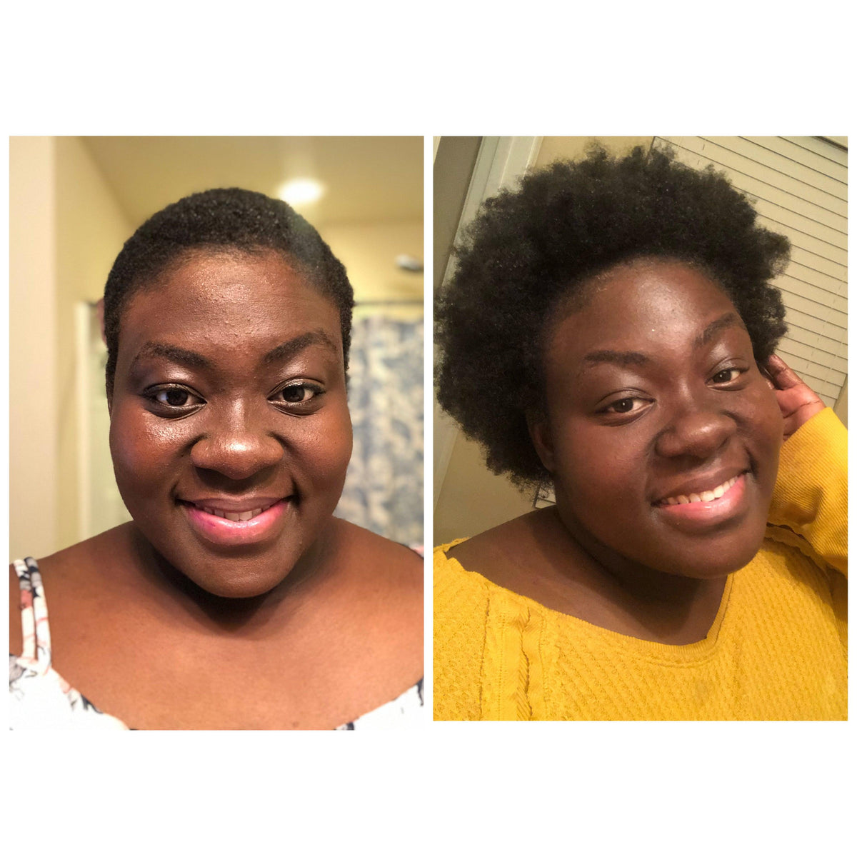 Hair Growth Shea Butter For Alopecia Balding In Men And Women hair-growth-shea-butter-for-alopecia-balding-in-men-and-women