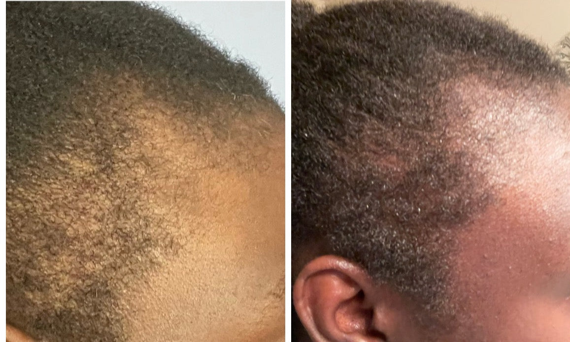Anti-breakage Hair Growth Shea Butter