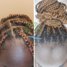 Load image into Gallery viewer, Before and After of hair growth transformation-alopecia in growth hair receding hairline hair falling out baldness balding men baldness in women balding head baldness cure bald hair
